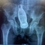 <b>DocBastard</b> - the 08/14/2012 at 12:38am